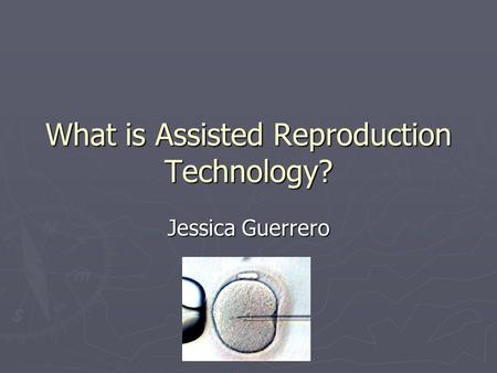 What is Assisted Reproduction Technology? Jessica Guerrero.