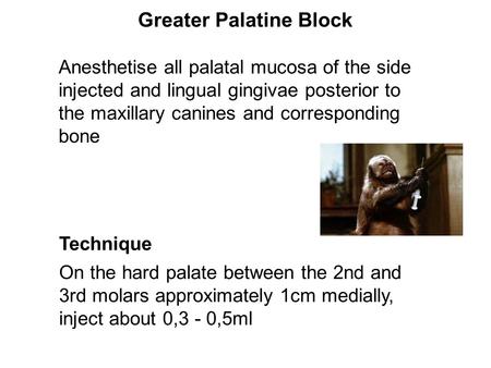 Greater Palatine Block