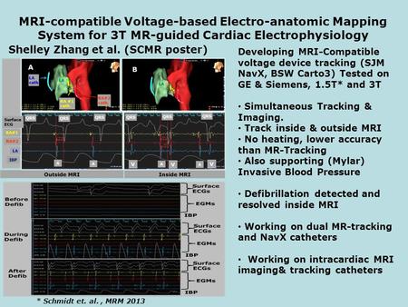 MRI-compatible Voltage-based Electro-anatomic Mapping System for 3T MR-guided Cardiac Electrophysiology Shelley Zhang et al. (SCMR poster) Developing MRI-Compatible.