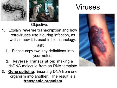 Viruses Objective: 1.Explain reverse transcription and how retroviruses use it during infection, as well as how it is used in biotechnology. Task: 1.Please.