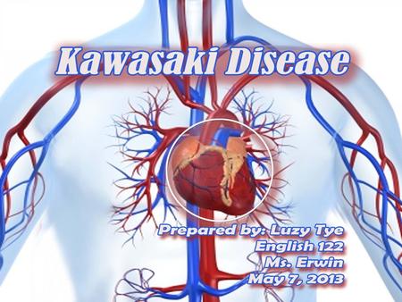 What is Kawasaki Disease? Kawasaki Disease (KD) also known as Kawasaki Syndrome. An unusual and serious illness of young children. It is an autoimmune.