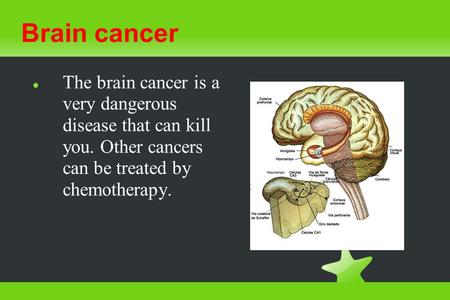 Brain cancer The brain cancer is a very dangerous disease that can kill you. Other cancers can be treated by chemotherapy.