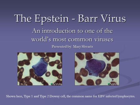 The Epstein - Barr Virus An introduction to one of the world’s most common viruses Presented by: Mary Shvarts Shown here, Type 1 and Type 2 Downy cell,