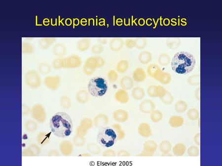 Leukopenia, leukocytosis