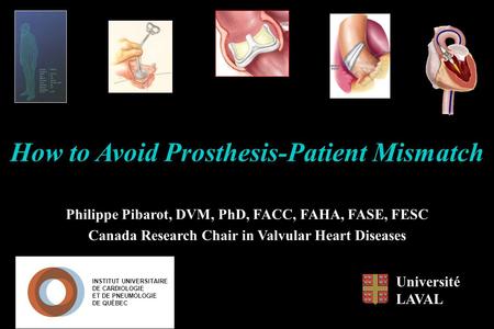 How to Avoid Prosthesis-Patient Mismatch