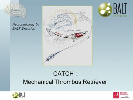 CATCH : Mechanical Thrombus Retriever