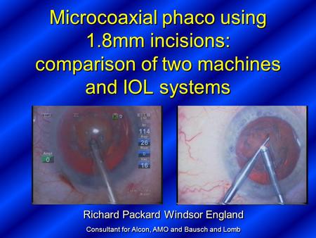 Microcoaxial phaco using 1