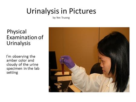 Physical Examination of Urinalysis I’m observing the amber color and cloudy of the urine specimen in the lab setting Urinalysis in Pictures by Yen Truong.
