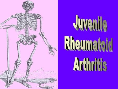 JRA is the most frequent chronic arthritis of children. The evidence of its was discovered from remained skeleton from 1000 years ago. It was prescribed.