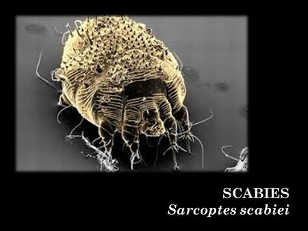 Scabies Sarcoptes scabiei