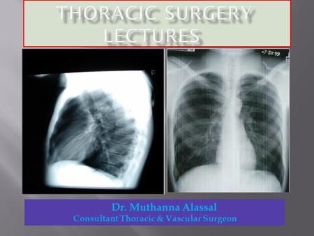 Dr. Muthanna Alassal Consultant Thoracic & Vascular Surgeon.