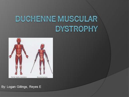 By: Logan Gillings, Reyes E. Cause Of Disease  Is a genetic disorder that causes progressive muscle weakness as individual muscle cells die.  An absence.