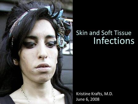 Skin and Soft Tissue Kristine Krafts, M.D. June 6, 2008 Infections.