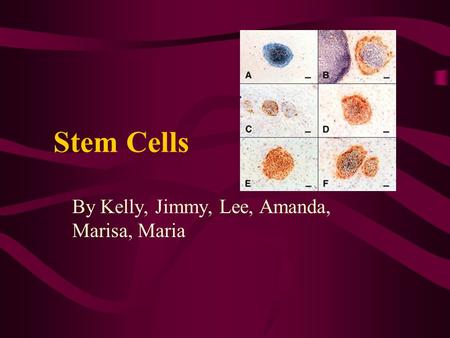 Stem Cells By Kelly, Jimmy, Lee, Amanda, Marisa, Maria.