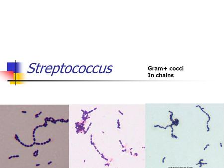 Streptococcus Gram+ cocci In chains.