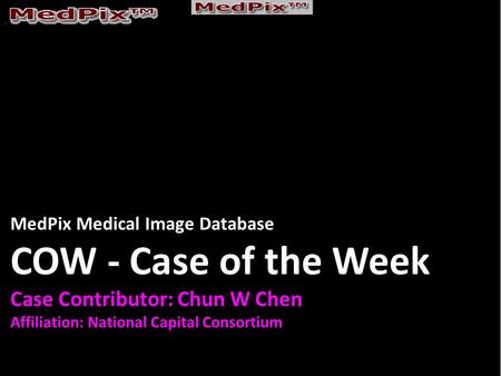 MedPix Medical Image Database COW - Case of the Week Case Contributor: Chun W Chen Affiliation: National Capital Consortium.