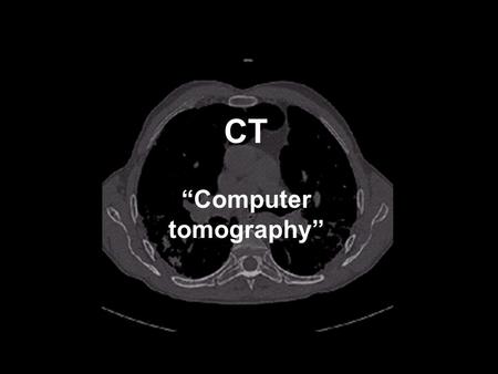 CT “Computer tomography”. Contrast mechanisms in X-ray imaging: X-ray absorption X-ray absorption mechanisms: 1. Photoelectric effect 2. Compton scatter.