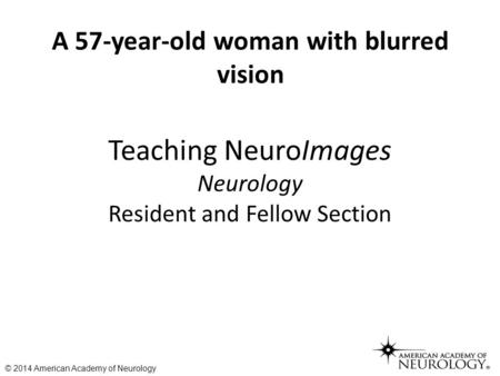 Teaching NeuroImages Neurology Resident and Fellow Section A 57-year-old woman with blurred vision © 2014 American Academy of Neurology.