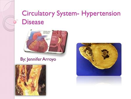 Circulatory System- Hypertension Disease By: Jennifer Arroyo.