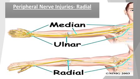 Peripheral Nerve Injuries- Radial