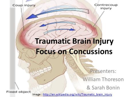 Traumatic Brain Injury Focus on Concussions