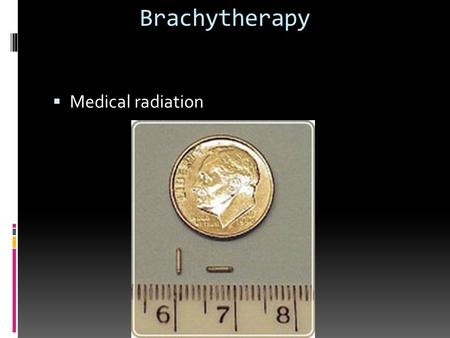 Brachytherapy Medical radiation.