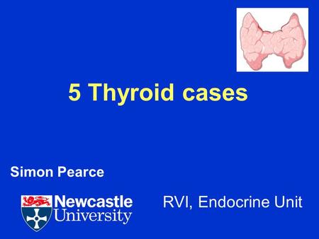 Simon Pearce 5 Thyroid cases RVI, Endocrine Unit.