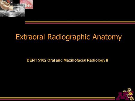 Extraoral Radiographic Anatomy