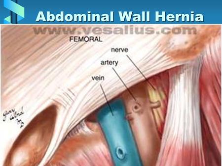 Abdominal Wall Hernia. DefinitionDefinition –External –Interparietal –Internal –Reducible –Non-reducible ( incarcerated) –Strangulated.