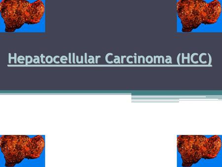 Hepatocellular Carcinoma (HCC). Definition : Hepatocellular carcinoma is a primary malignancy of the hepatocyte, also known as liver cell carcinoma. Types.