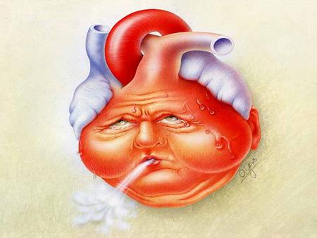U 1. 2 CONGESTIVE HEART FAILURE Is a complex, progressive disorder in which the heart is unable to pump sufficient blood to meet the demands of the body.