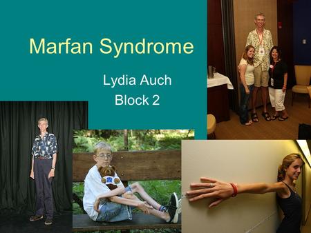 Marfan Syndrome Lydia Auch Block 2.