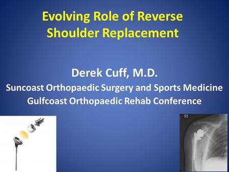 Evolving Role of Reverse Shoulder Replacement Derek Cuff, M.D. Suncoast Orthopaedic Surgery and Sports Medicine Gulfcoast Orthopaedic Rehab Conference.