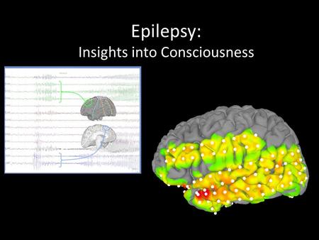 Epilepsy: Insights into Consciousness. Obligatory Historical Quote: “Men ought to know that from the brain, and from the brain only, arise our pleasures,