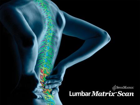 1SpineMatrix. Product 2 SMI has developed the Lumbar Matrix System A unique spinal physiology imaging scan used to diagnose disc, facet and chronic LBP.