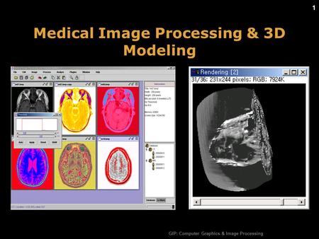 GIP: Computer Graphics & Image Processing 1 1 Medical Image Processing & 3D Modeling.