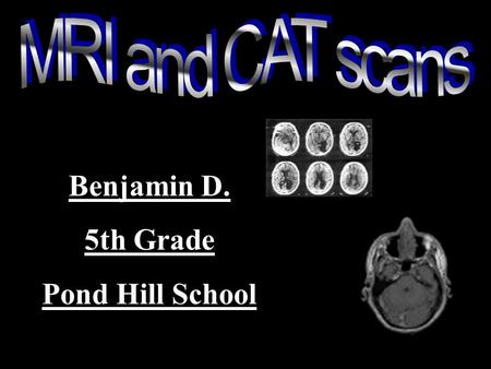 Benjamin D. 5th Grade Pond Hill School I’ve always loved the human body, and I’ve researched it for quite a while. I also love computers and electronics,