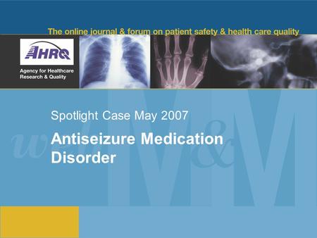 Spotlight Case May 2007 Antiseizure Medication Disorder.