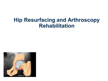 Hip Resurfacing and Arthroscopy Rehabilitation. Role of the Physiotherapist Pre-operative guidance and information Guide rehabilitation Motivation Support.