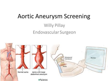 Aortic Aneurysm Screening