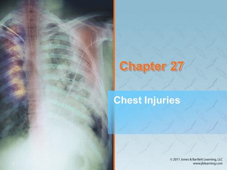 Chapter 27 Chest Injuries. Anatomy and Physiology (1 of 5) Ventilation is the body’s ability to move air in and out of the chest and lung tissue. Respiration.