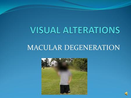 MACULAR DEGENERATION Macular Degeneration Types: -Atrophic (age-related) :dry -Exudative :wet Populations at Risk: Greater than 60 yrs. Old Females >