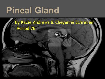 Pineal Gland By Kacie Andrews & Cheyanne Schreiner Period 7B.
