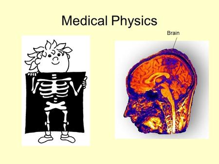 Medical Physics Brain.