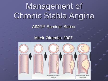 Management of Chronic Stable Angina AIMGP Seminar Series Mirek Otremba 2007.