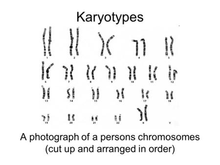 A photograph of a persons chromosomes (cut up and arranged in order)
