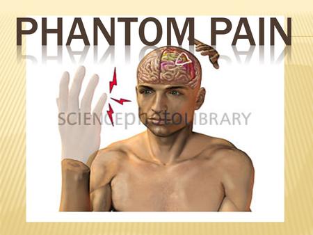  Phantom pain is pain that feels like it's coming from a body part that's no longer there. Doctors once believed this post-amputation phenomenon was.