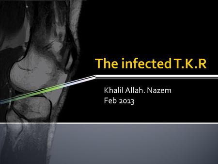 Khalil Allah. Nazem Feb 2013.  In the face of an increasing prevalence of TKA, intensified efforts at infection prevention seem logical to reduce the.