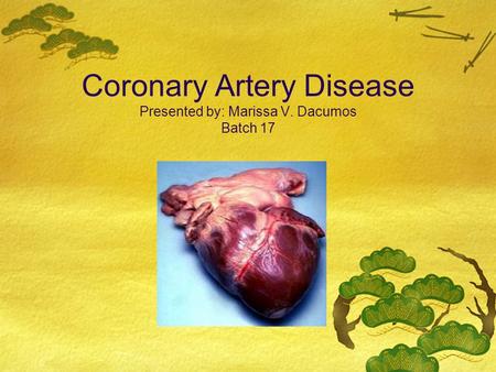 Coronary Artery Disease Presented by: Marissa V. Dacumos Batch 17