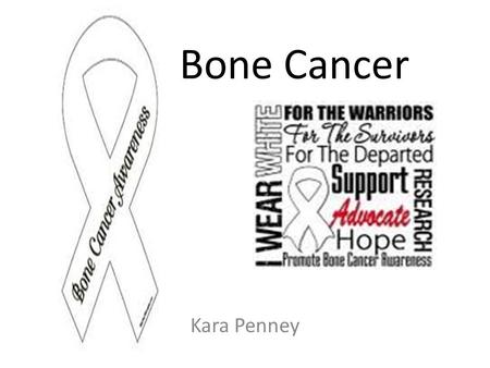 Kara Penney Bone Cancer. Osteosarcoma Chondrosarcoma The Ewing Sarcoma Family of Tumors (ESTFs) Types of Bone Cancer.